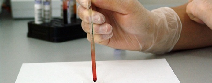 Po rajonus važinėsiančioje mobilioje laboratorijoje – nemokamas vyrų kraujo tikrinimas dėl prostatos vėžio