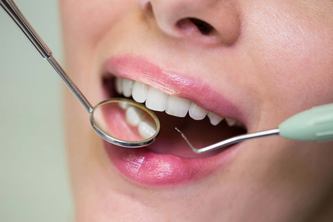 Kiek laiko tarnauja dantų implantas?